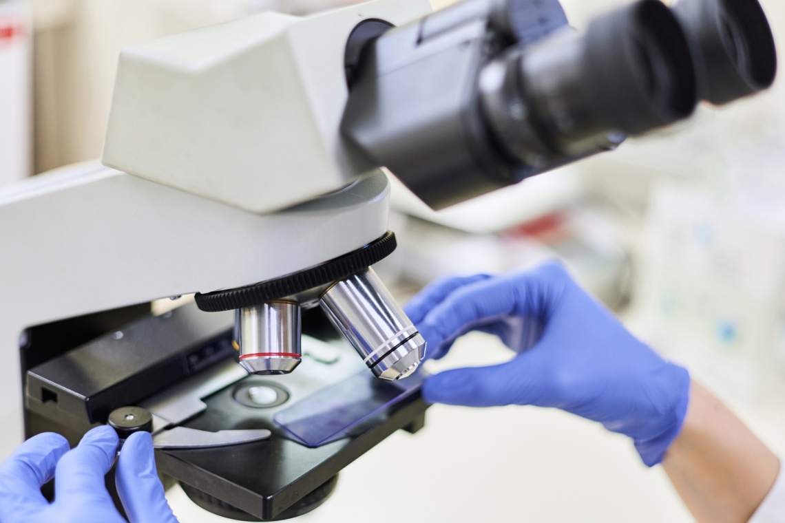 Biopsia per esame citologico e biospia per esame istologico: di cosa parliamo?